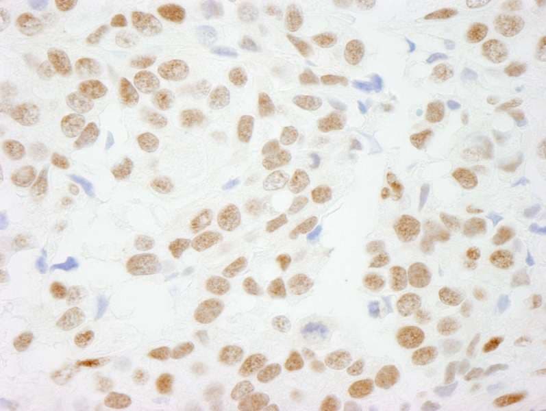 CTBP1 / CTBP Antibody (aa400-440)