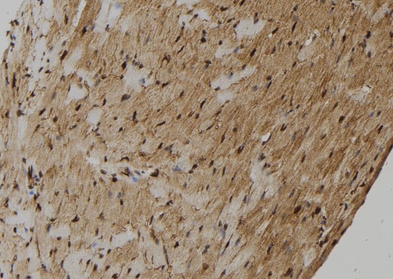 Polyclonal Rabbit anti-Human ZMYM4 / ZNF262 Antibody (IHC, WB)