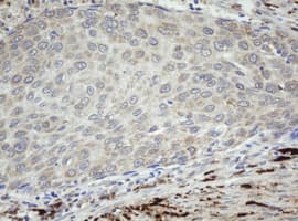 F13A1 / Factor XIIIa Antibody (clone OTI3F8)
