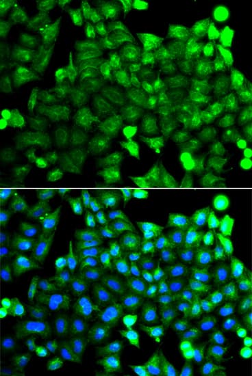 IHC-plus™ NCALD / Neurocalcin Delta Antibody