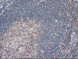 PLEKHA3 Antibody (clone OTI6E4)