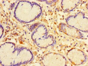 Polyclonal Rabbit anti-Human CA11 / Carbonic Anhydrase XI Antibody