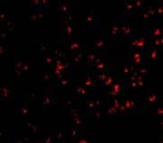 IHC-plus™ Polyclonal Rabbit anti-Human CHUK / IKKA / IKK Alpha Antibody (IHC, IF, WB)