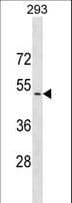 NECL-1 / CADM3 Antibody (aa158-186)
