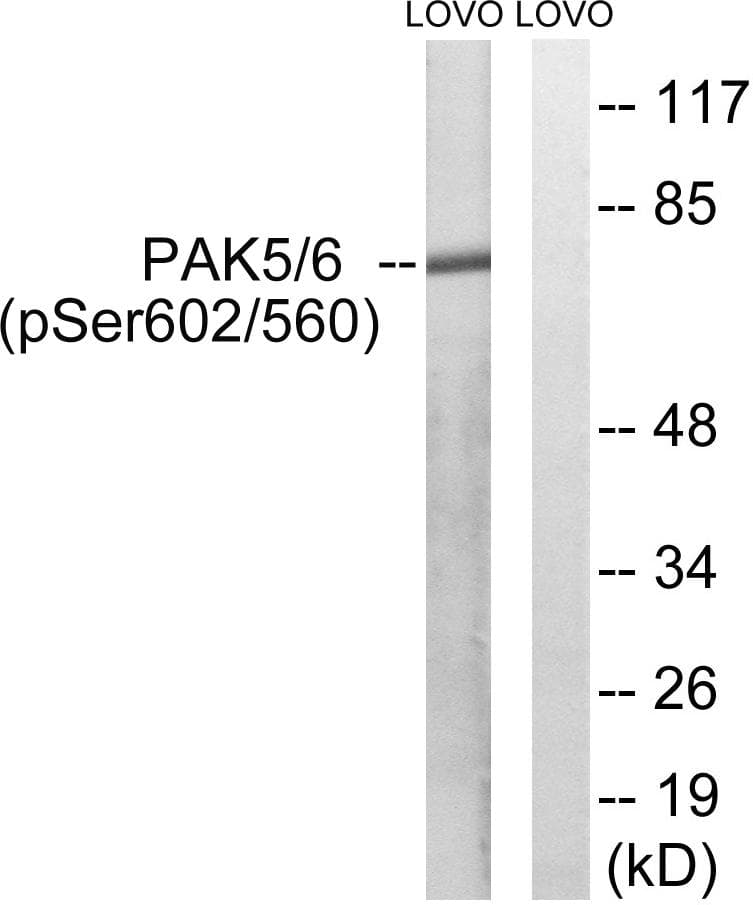 Polyclonal Rabbit anti-Human PAK5 + PAK6 Antibody (phospho-Ser602/Ser560, WB)