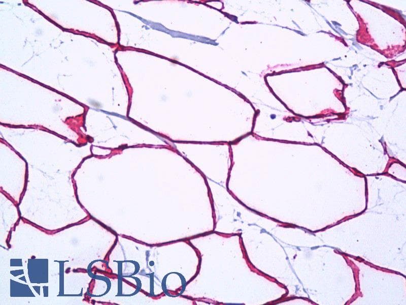 IHC-plus™ Polyclonal Rabbit anti-Human PTRF / CAVIN Antibody (aa1-30, IHC, WB)
