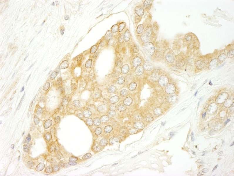 BRAF / B-Raf Antibody (aa25-75)