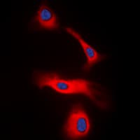 Lymphotoxin-Beta / LTB Antibody (C-Terminus)