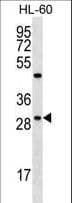 FMR1NB Antibody (aa1-30)