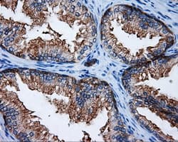 Monoclonal Mouse anti-Human RIP1 / RALBP1 Antibody (clone OTI2A6, IHC, IF, WB)