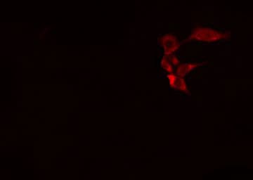 Polyclonal Rabbit anti-Human CASP1 / Caspase 1 Antibody (phospho-Ser376, IF, WB)