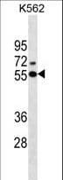 ESR2 / ER Beta Antibody (aa369-397)