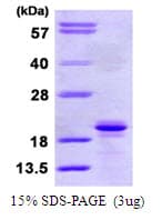 Human SIT1 Protein (Recombinant His)
