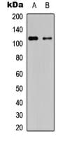PRKD1 + PRKD2 + PRKD3 Antibody (phospho-Ser738/742)