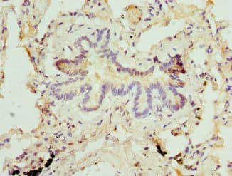 Polyclonal Rabbit anti-Human MBTPS1 / S1P Antibody (IHC, WB)