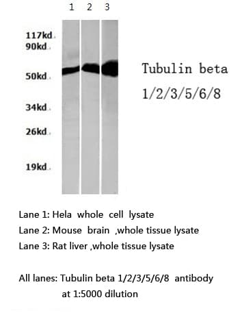 Tubulin Beta 1+2+3+5+6+8 Antibody