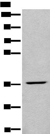 Polyclonal Rabbit anti-Human LDAH Antibody (IHC, WB)