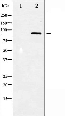 STAT3 Antibody (phospho-Tyr705)