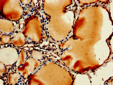 Polyclonal Rabbit anti-Human RPL11 / Ribosomal Protein L11 Antibody (IHC, IF)