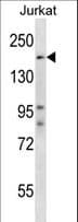 SPT5 / SUPT5H Antibody (aa395-424)