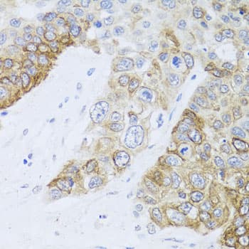 Polyclonal Rabbit anti-Human CHD1 Antibody (IHC, WB)