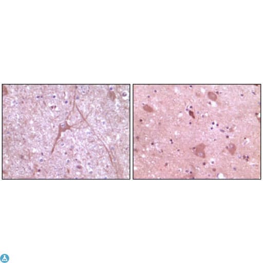 DNM2 / Dynamin-2 Antibody