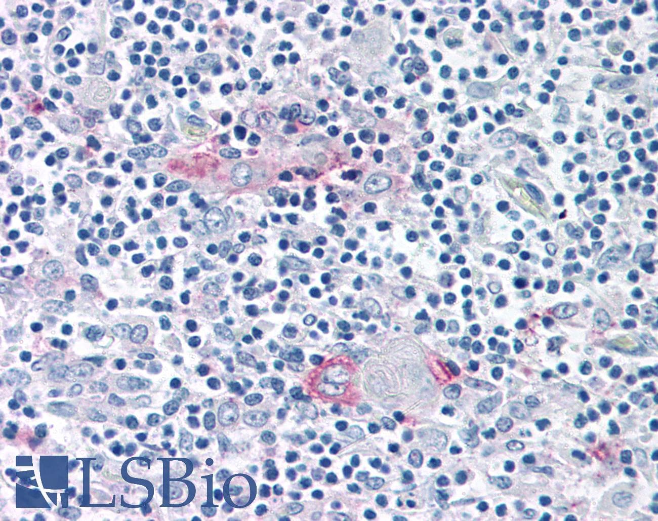 IHC-plus™ RORC / ROR Gamma Antibody (Ligand-binding Domain)
