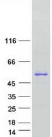 Human ATXN3 / JOS Protein (Recombinant Myc-DDK (Flag))