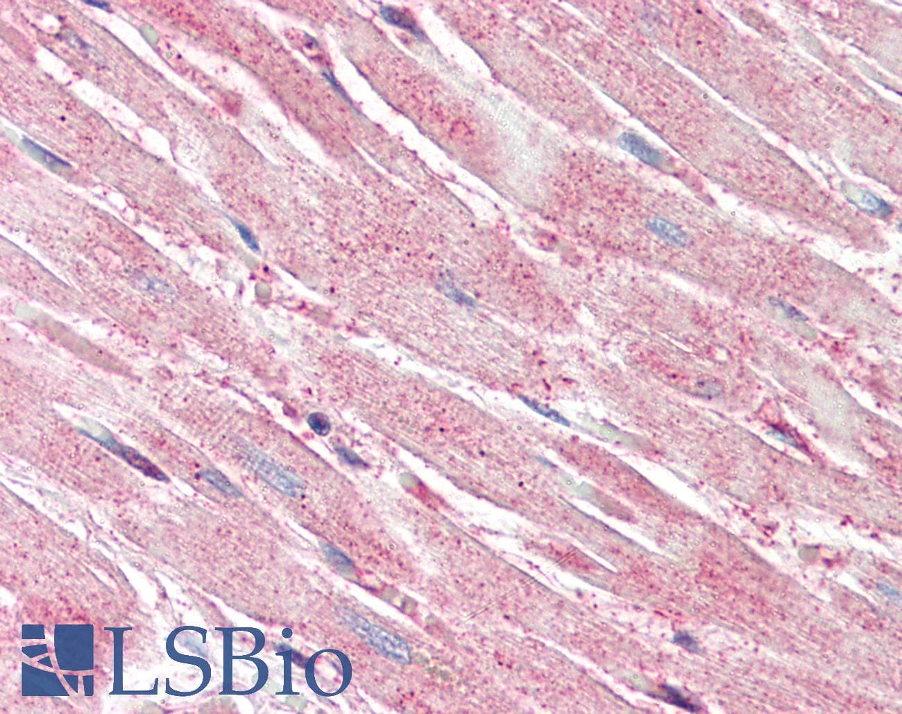 Polyclonal Rabbit anti-Human CASP1 / Caspase 1 Antibody (IHC, WB)