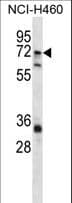 ST6GALNAC1 Antibody (aa28-57)