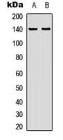 ZC3H4 Antibody (Internal)
