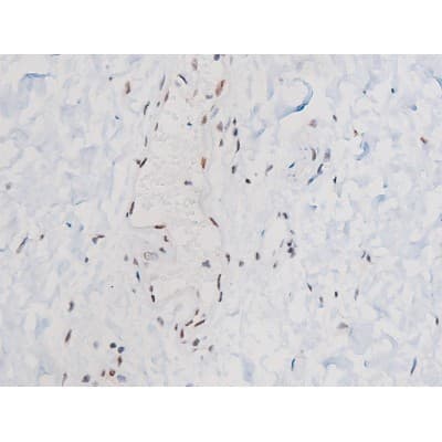 STAT3 Antibody (phospho-Ser727)