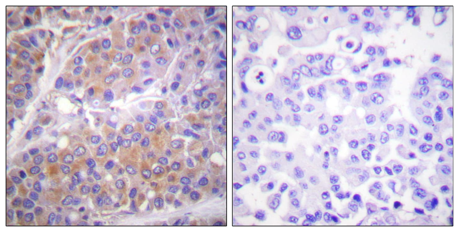 RPS6KB1 / P70S6K / S6K Antibody (phospho-Ser371)