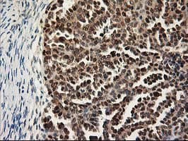 ALS2CR1 / NIF3L1 Antibody (clone OTI3E1)