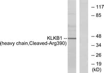 IHC-plus™ Polyclonal Rabbit anti-Human KLKB1 / Plasma Kallikrein Antibody (aa341-390, IHC, WB)