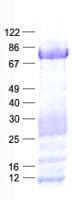 Human EEYORE / TIGD1 Protein (Recombinant His, N-Terminal)