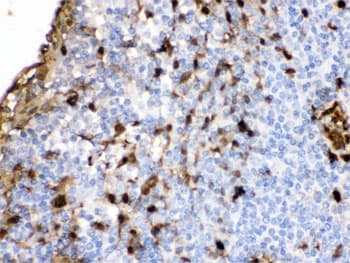 Polyclonal Rabbit anti-Human S100A9 / MRP14 Antibody (IHC, WB)