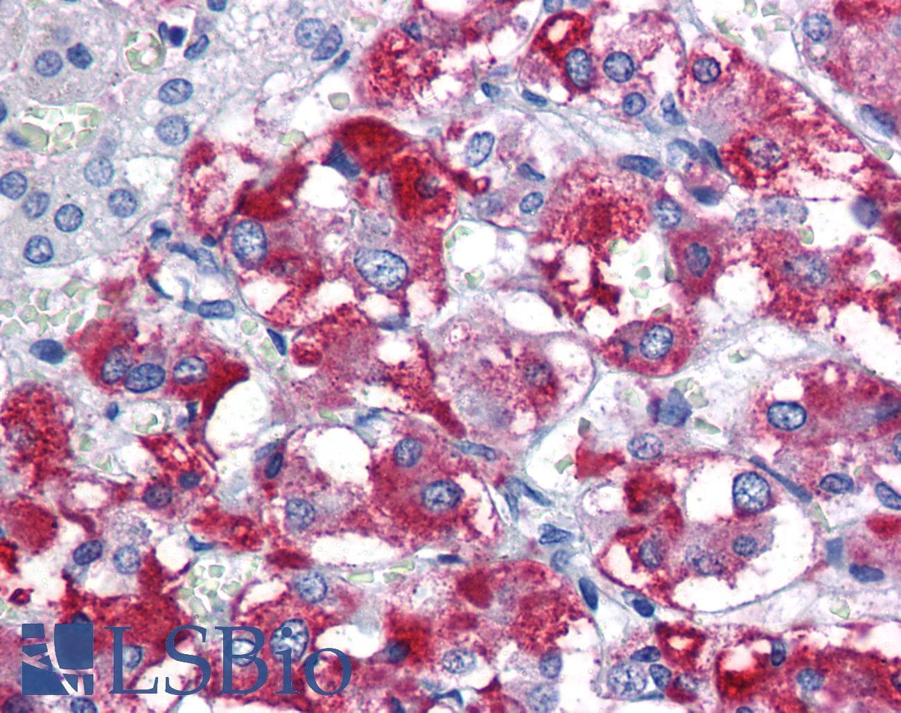 PARK2 / Parkin 2 Antibody (aa311-360)
