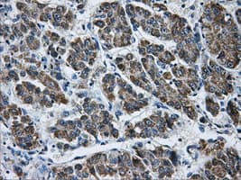 AKR1A1 Antibody (clone OTI8E12)