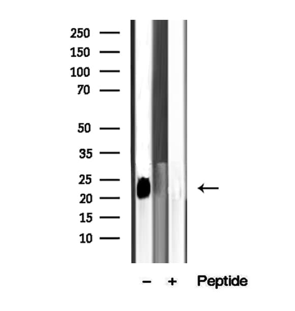 ARL8B Antibody