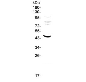MVD Antibody