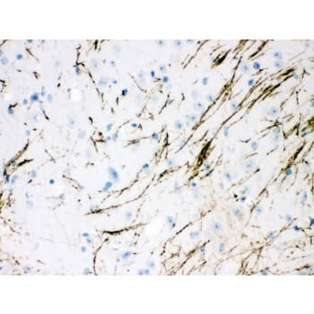 TH / Tyrosine Hydroxylase Antibody (aa193-222)