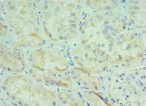 Polyclonal Rabbit anti-Human BOC Antibody (aa1-125, IHC)