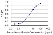 KRT34 / Keratin 34 / KRTHA4 Antibody (clone 3E5)