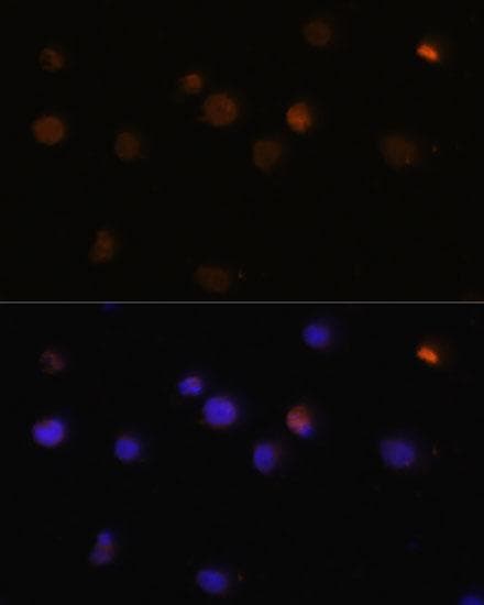 RB1 / Retinoblastoma / RB Antibody