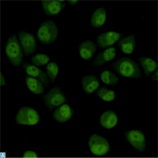 TBL1XR1 / TBLR1 Antibody
