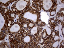 NME1 / NM23 Antibody (clone OTI6E9)