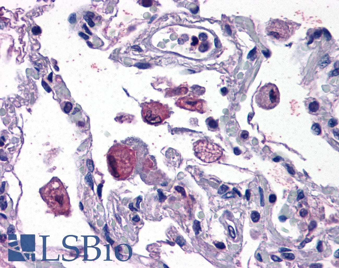 IHC-plus™ Polyclonal Goat anti-Human ALOX5AP / FLAP Antibody (aa28-40, IHC, WB)