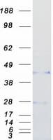 Human CCN5 Protein (Recombinant Myc-DDK (Flag))