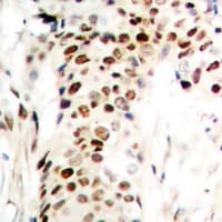 RREB1 Antibody (Internal)